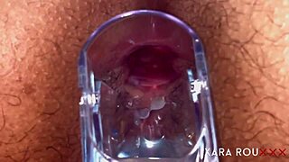 Anal Vision with Speculum on Sexy Hairy Slut with Huge Natural Tits