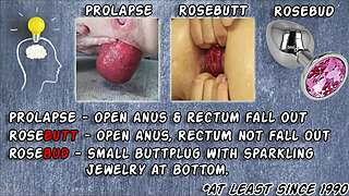 I Mean, Hotkinkyjo Wears See-Through Open-Crotch Swimsuit For Self Anal Fisting And Prolapse Outdoors