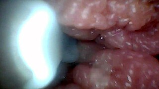 Endoscope camera reveals the most sensitive parts of the penis in this educational video