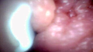 Endoscope camera reveals the most sensitive parts of the penis in this educational video