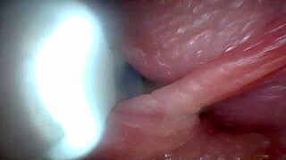 Endoscope camera reveals the most sensitive parts of the penis in this educational video